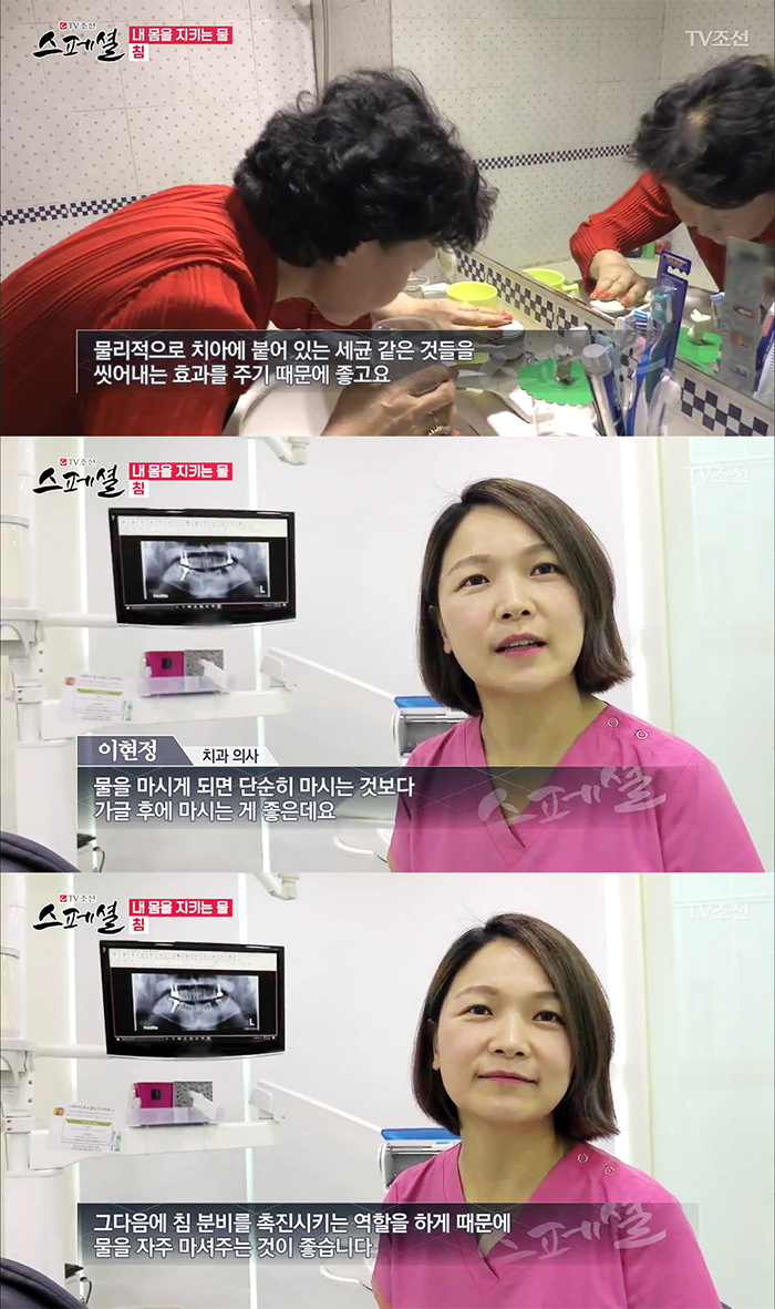 TV조선 스페셜 50회 구강건강관리 관련 이미지 13