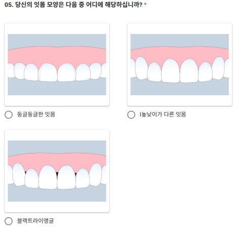 테일러 비니어 (진료일기) 관련 이미지 3