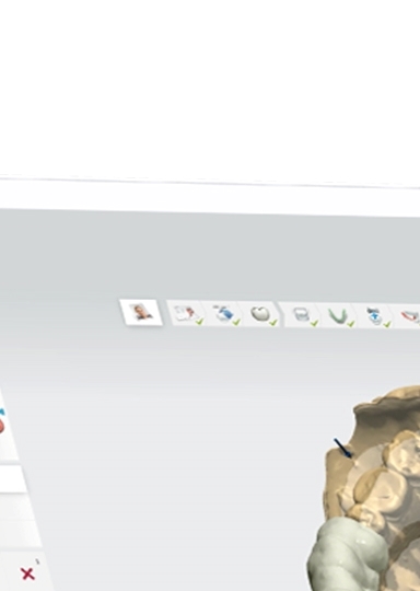 디지털임플란트 당일임플란트로 정확하고 안전하다면 관련 이미지 17