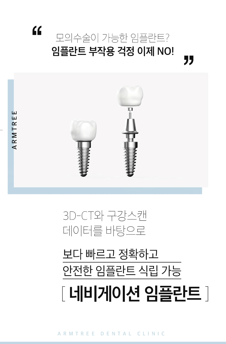 컴퓨터분석임플란트 아름드리치과의 네비게이션이 정답! 관련 이미지 2