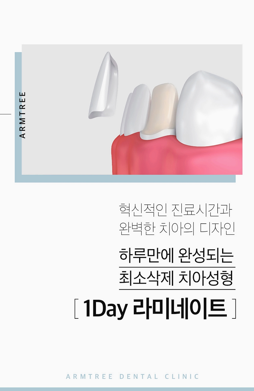 앞니라미네이트 후기가 많은 아름드리치과 관련 이미지 2