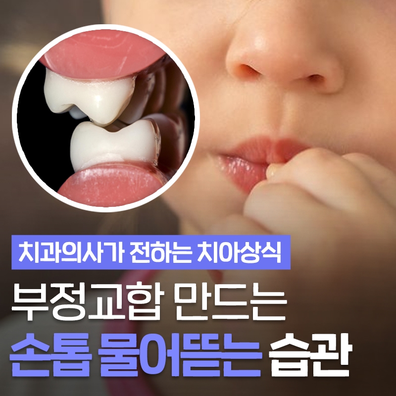 손톱 물어뜯는 버릇 아이의 부정교합 야기한다! 이현정의물음표 관련 이미지 1