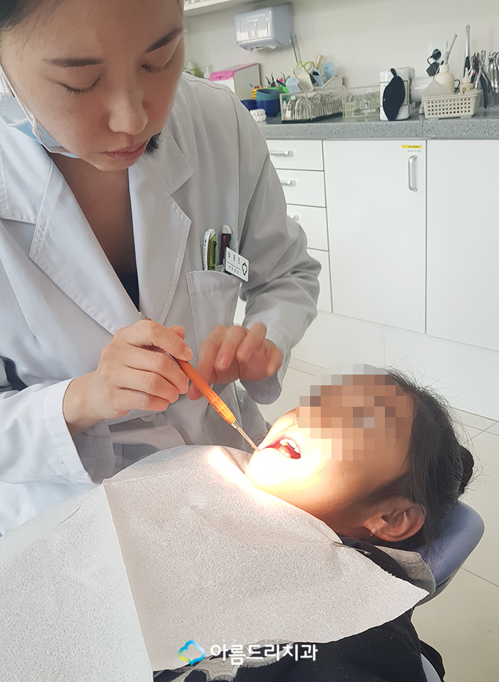 어린이치아교정 부정교합 RPE(급속구개확장장치) 악궁확장장치 관련 이미지 3