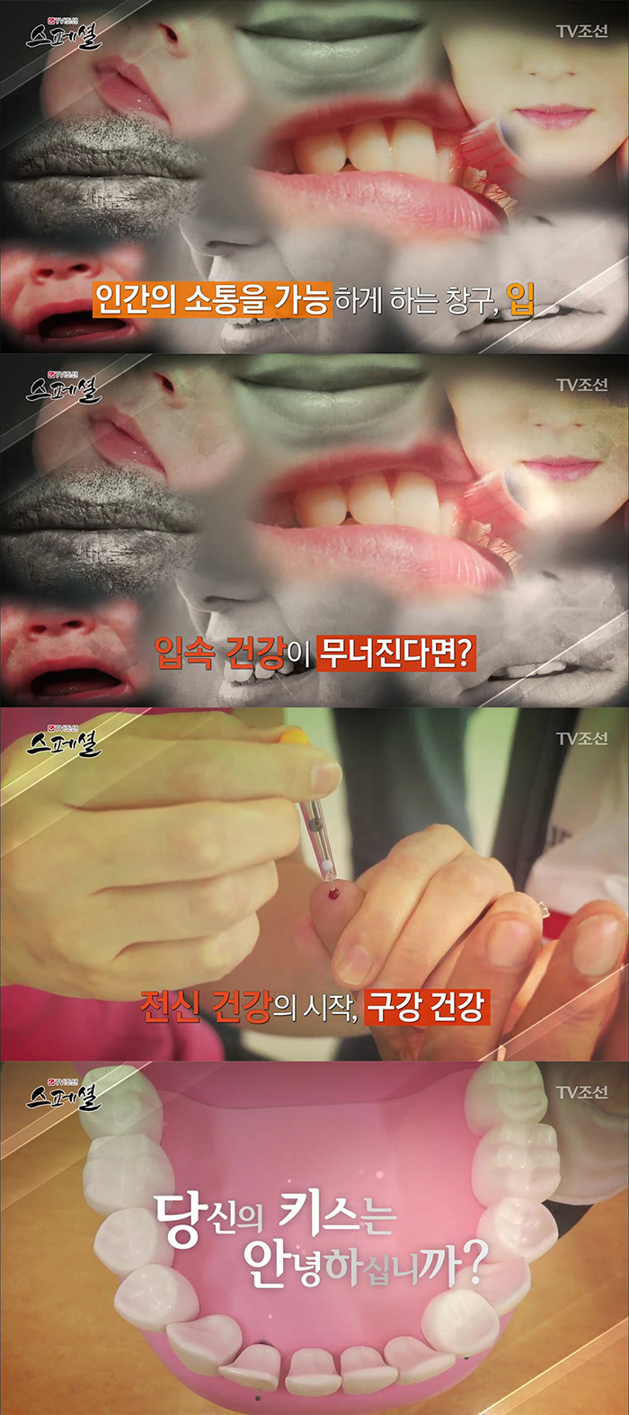 TV조선 스페셜 50회 구강건강관리 관련 이미지 2