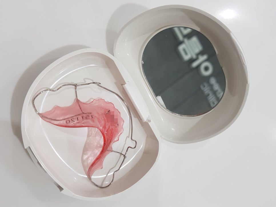 치아교정 후 유지 장치 세척&관리법 Tip_강남 아름드리 치과 관련 이미지 15