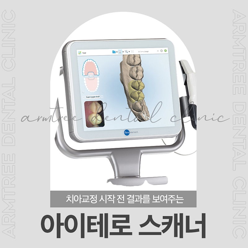 3D 구강스캐너 아이테로를 통한 치아교정 아름드리치과 관련 이미지 1