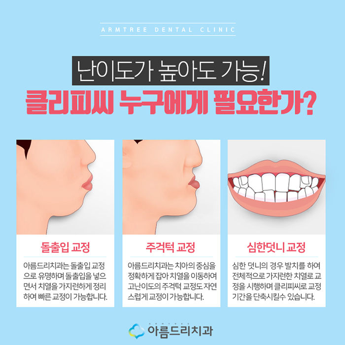 클리피시교정 덜아프고 빠르게 관련 이미지 5