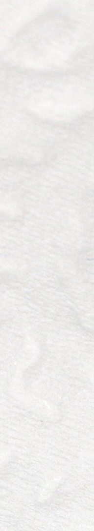 신논현치과 사랑니발치 치과는 신중하게 관련 이미지 12