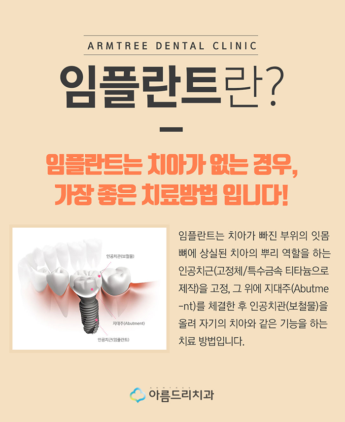 컴퓨터분석 임플란트 비용 아름드리 관련 이미지 2