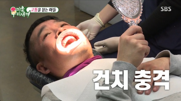 미우새 건치 김건모 풍치 이유는? 술&담배 관련 이미지 1