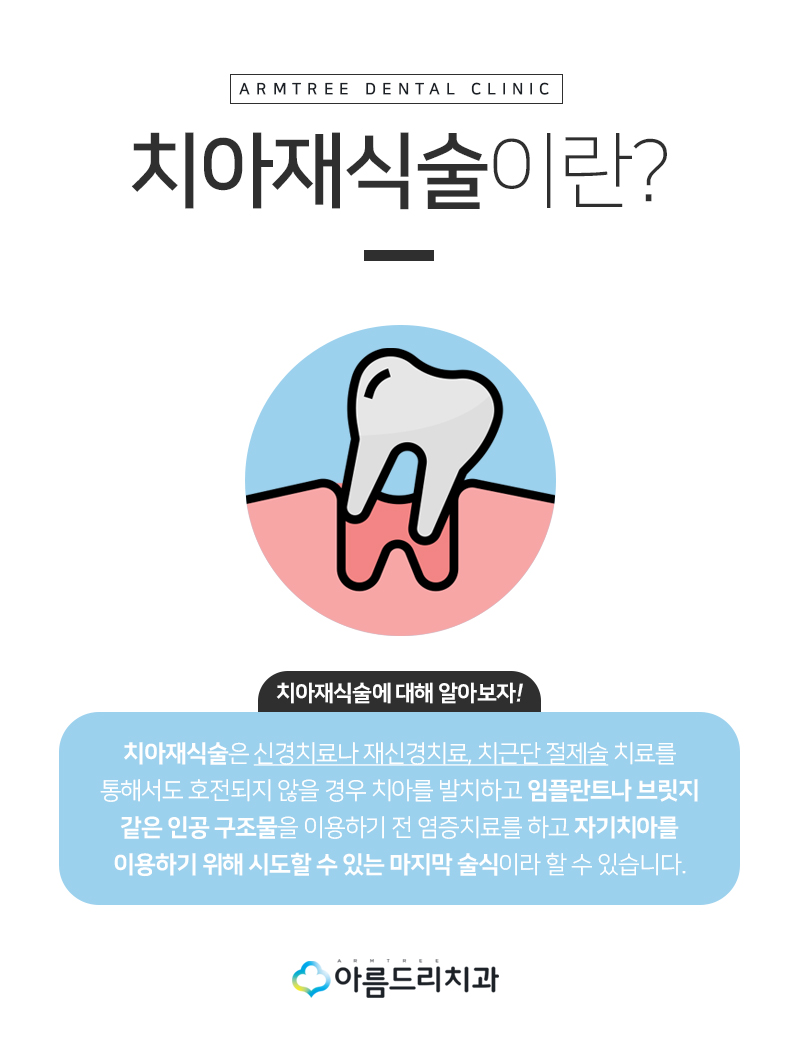 치아재식술 후기 자연치아지키기 관련 이미지 5