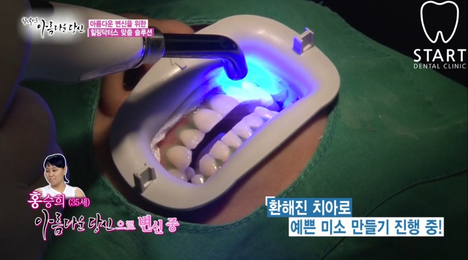 이현정 원장의 아름다운 당신 시즌 1 (9회 홍승희 도전자) 잇몸미백, 치아미백 관련 이미지 4