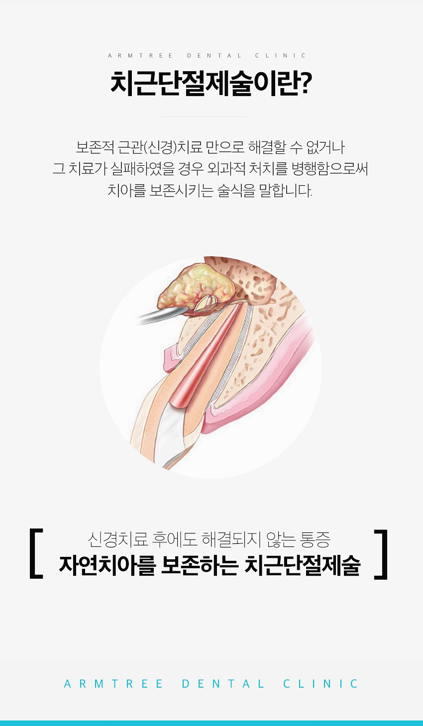 치근단절제술 염증 신뢰있는 후기 아름드리치과 관련 이미지 4
