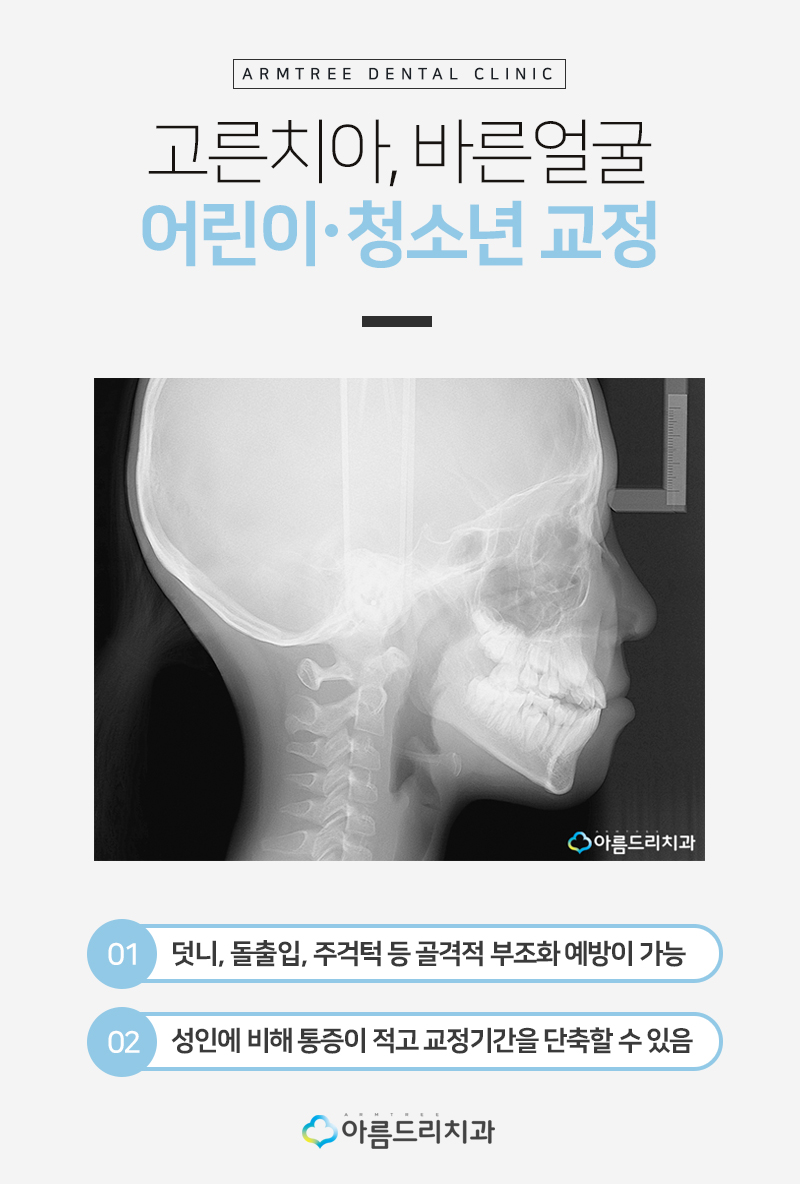 어린이치아교정 부정교합 리얼스토리#2 관련 이미지 12