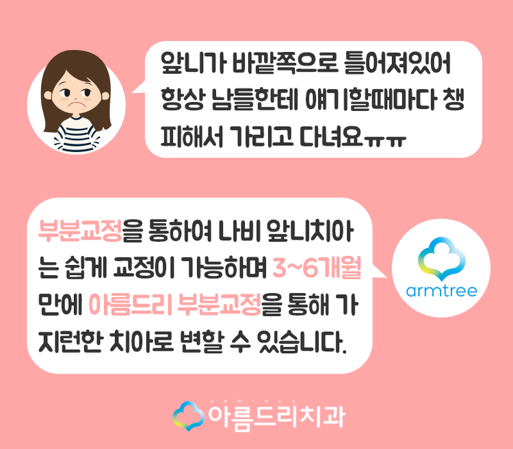 부분치아교정 틀어진앞니 후기역시 관련 이미지 2