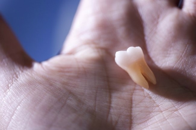 아름드리치과_빠진 치아를 그대로 두면? 관련 이미지 1