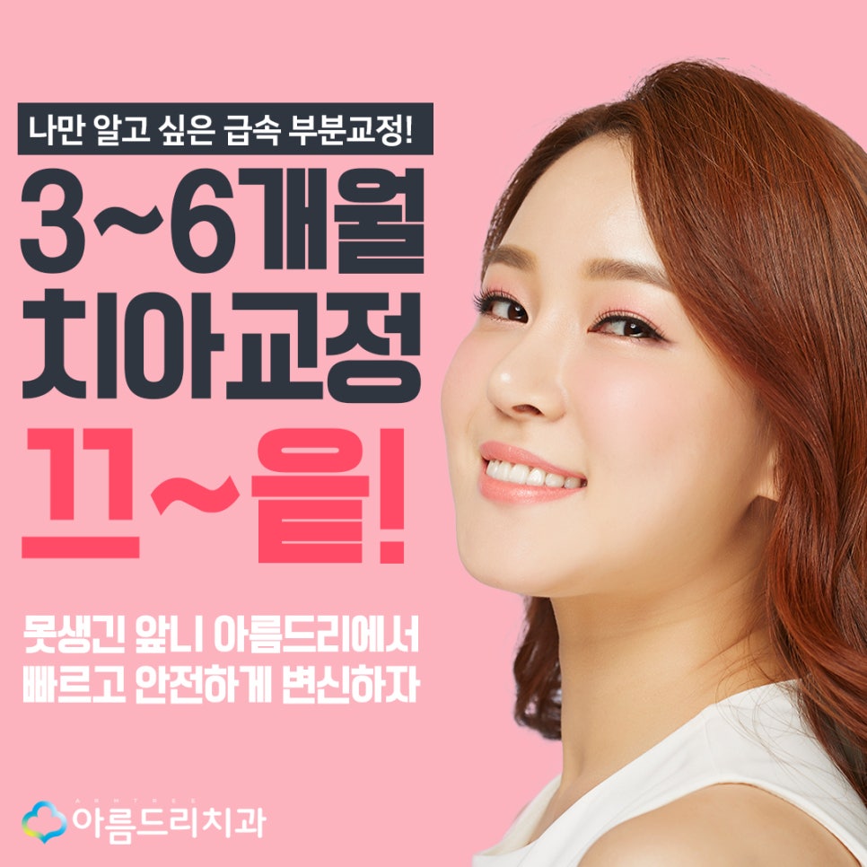 앞니벌어짐 교정 부분교정 후기가 말한다 관련 이미지 3
