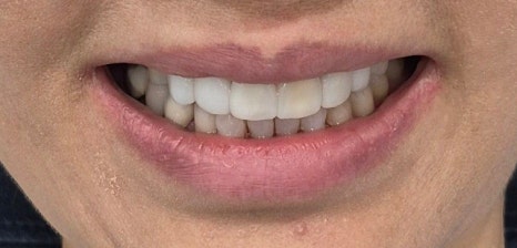 테일러 비니어 (진료일기) 관련 이미지 12