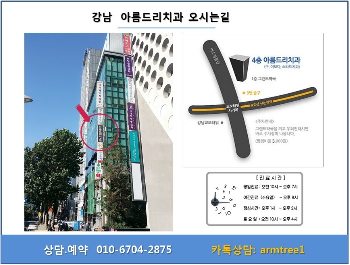 투명교정으로 가지런한 앞니 완성 관련 이미지 7