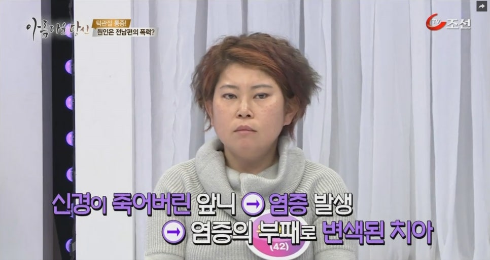 이현정원장의 아름다운 당신 시즌 2 (8회 윤해숙 도전자) 치주치료, 충치치료, 원데이 임플란트, 네비게이션 임플란트, 돌출입 심미보철, 치아미백, 스마일 트레이닝 관련 이미지 4