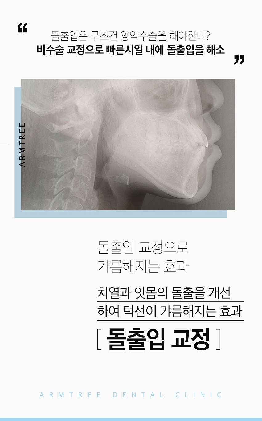 치아교정종류 신뢰가는 신논현역치과 관련 이미지 4