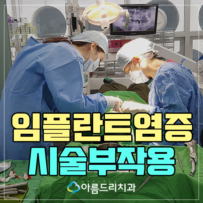 임플란트염증 시술부작용 걱정없이 관련 이미지 1