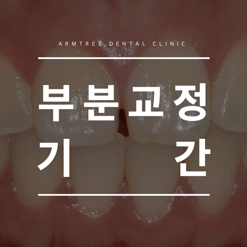 부분교정기간 부담제로 신논현역 아름드리치과 관련 이미지 1