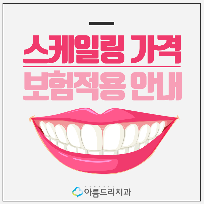스케링가격(스켈링가격) 치과 스케일링 보험적용 관련 이미지 1