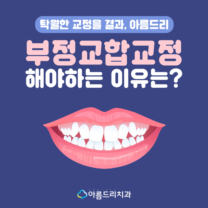 치아 부정교합교정 꼭 필요한 이유 관련 이미지 1