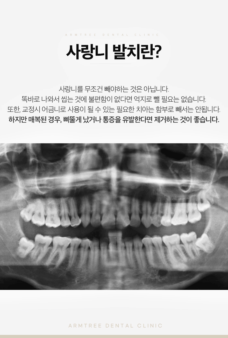 신논현역 사랑니발치는 체계적인 아름드리치과 관련 이미지 3
