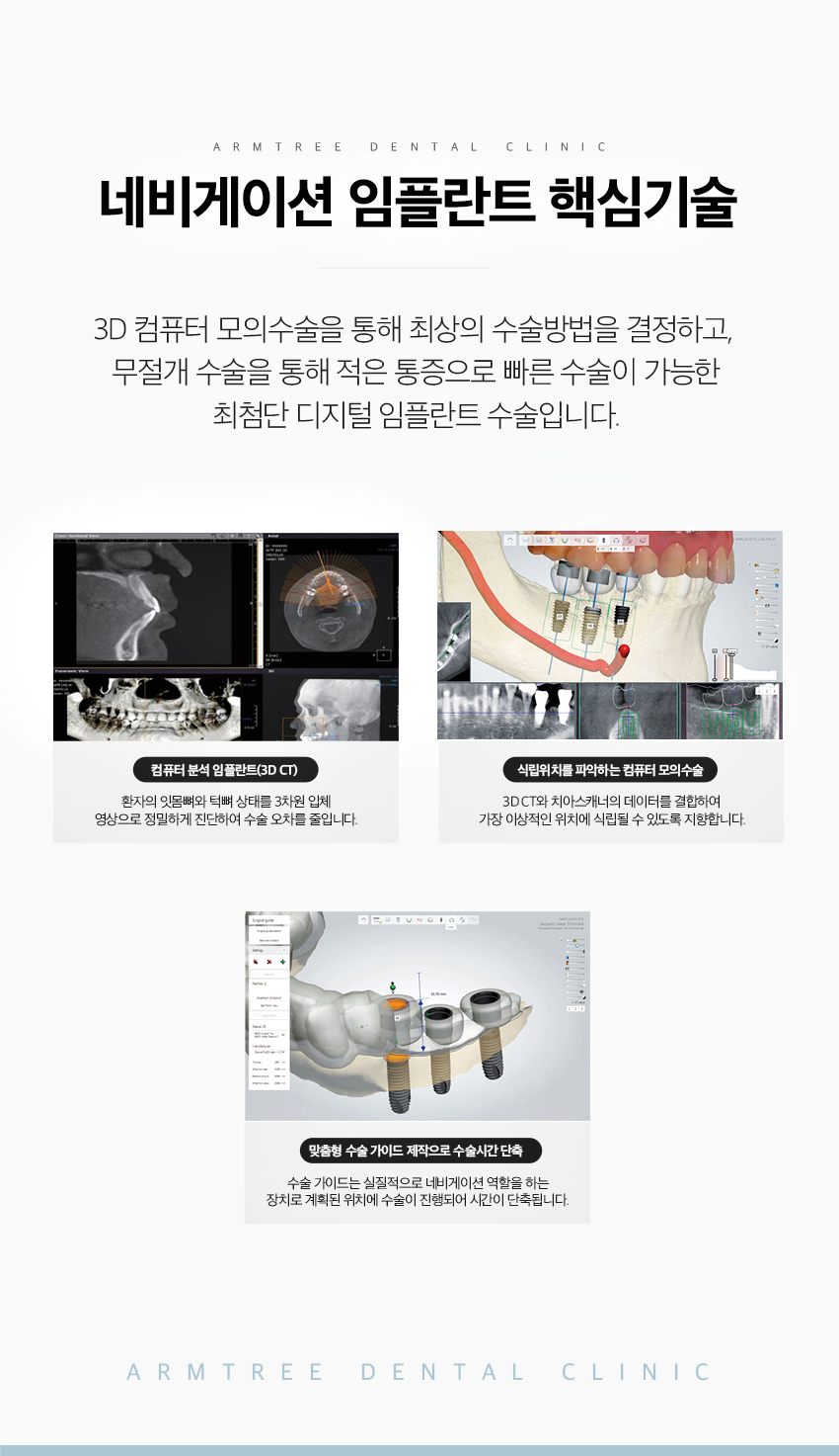 신논현역치과 임플란트 고민이라면 관련 이미지 5