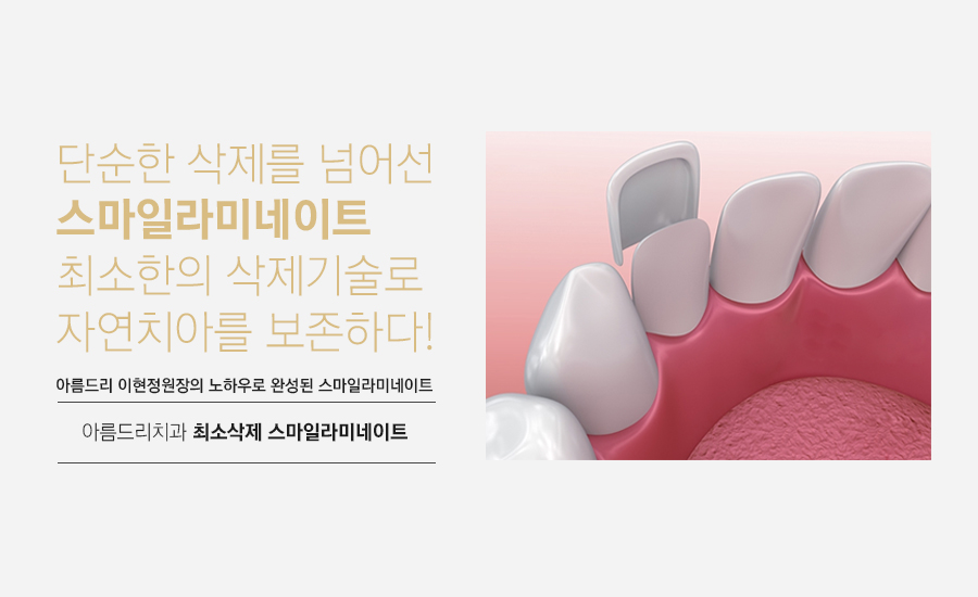 라미네이트연예인 이빨(치아) 최소삭제 이거다 관련 이미지 9