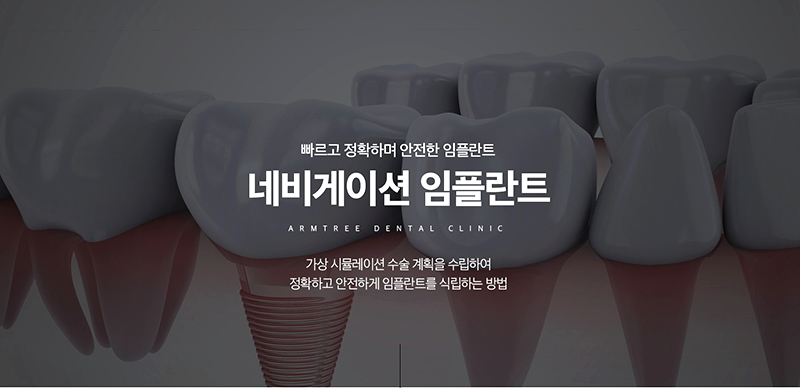 아름드리치과 임플란트의 안전성과 정확성을 높이다 관련 이미지 2