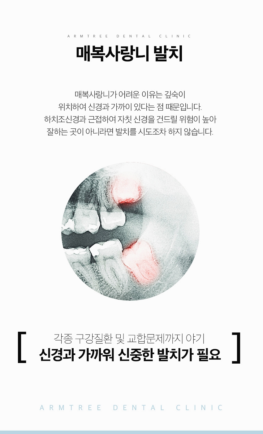 매복사랑니 발치후기 통증없는 아름드리치과 관련 이미지 3