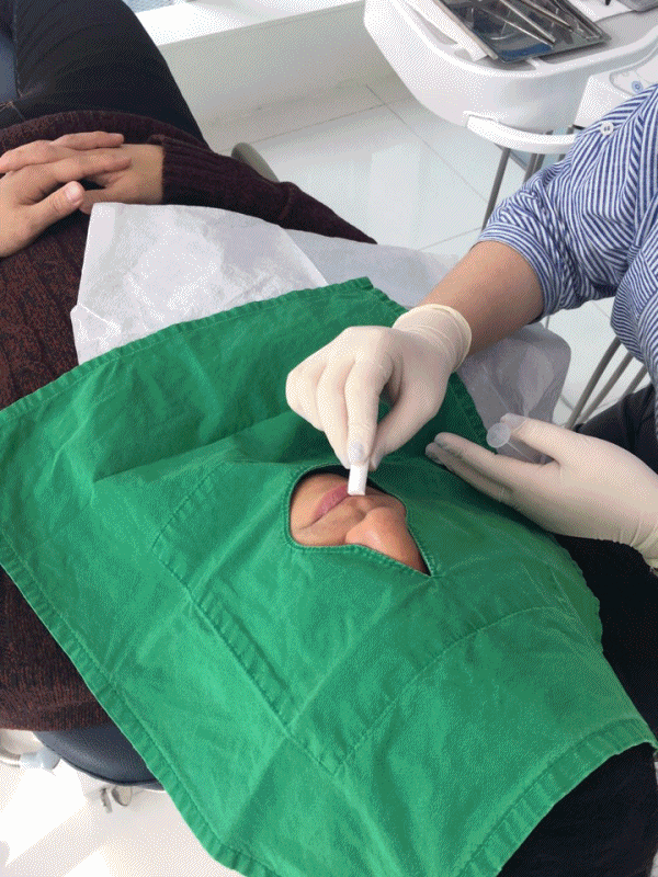 신논현역치과 아름드리치과에서 건강한 치아미백, 전문가 미백 관련 이미지 12