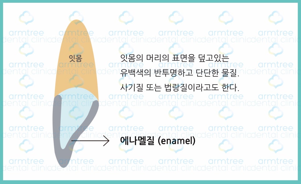 아름드리치과 이현정원장의 치료 이야기- 라미네이트란? 관련 이미지 5