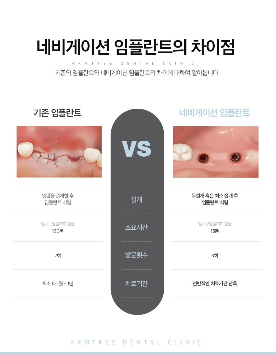 컴퓨터분석임플란트 아름드리치과의 네비게이션이 정답! 관련 이미지 4