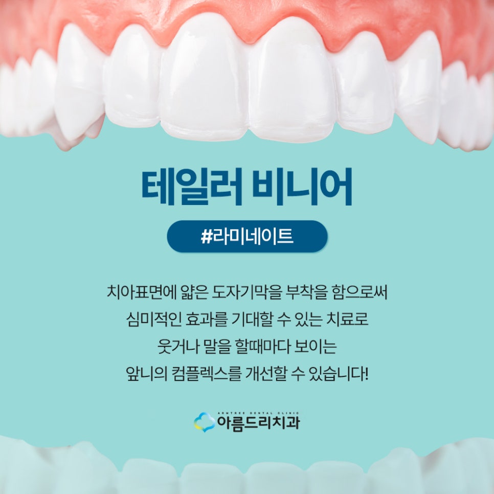 강남 연예인들이 많이 찾는 치아성형 자연스러운 무삭제 라미네이트 치아성형 관련 이미지 2