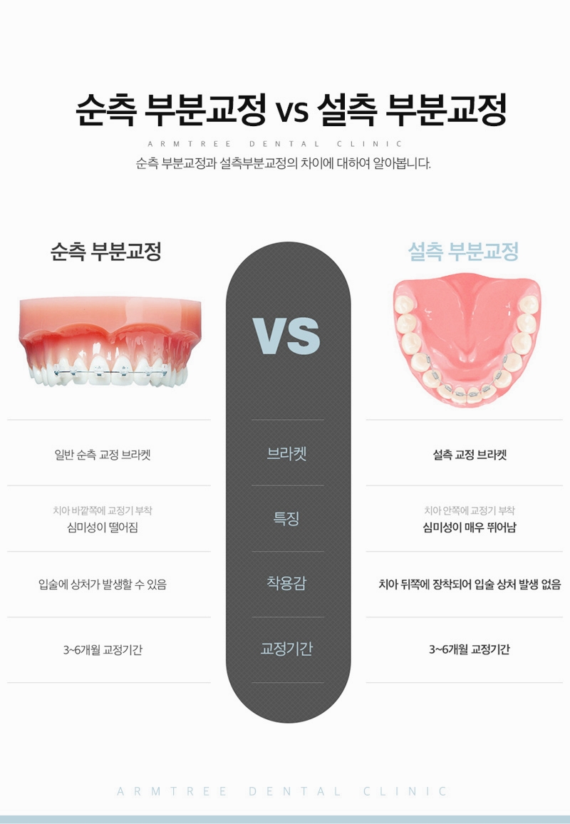아랫니부분교정 아랫니만 가능한 아름드리치과 관련 이미지 6