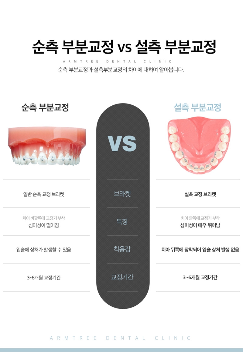 부분교정기간 다양한후기 아름드리치과 관련 이미지 6