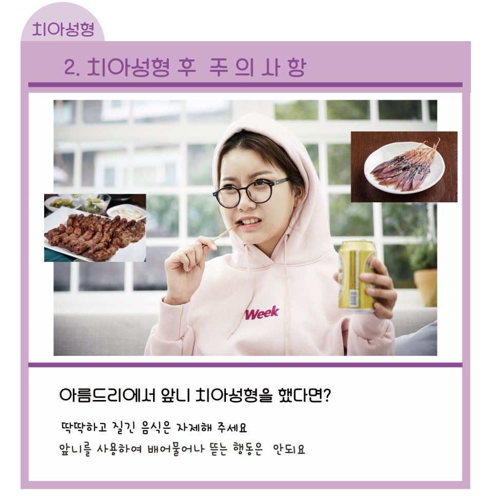 라미네이트,올세라믹으로 연예인치아 (주의사항)_아름드리치과 관련 이미지 17