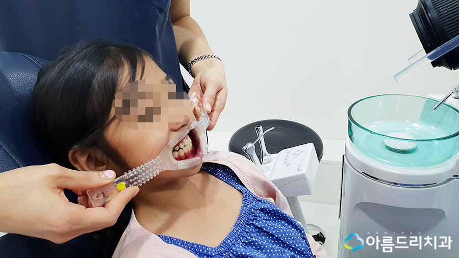 어린이치아교정 부정교합 리얼스토리#2 관련 이미지 2