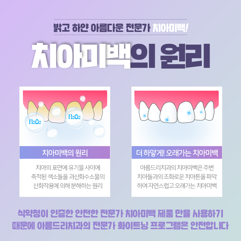 연예인치아미백 백도빈 정시아 치과 르브레드랩 관련 이미지 6