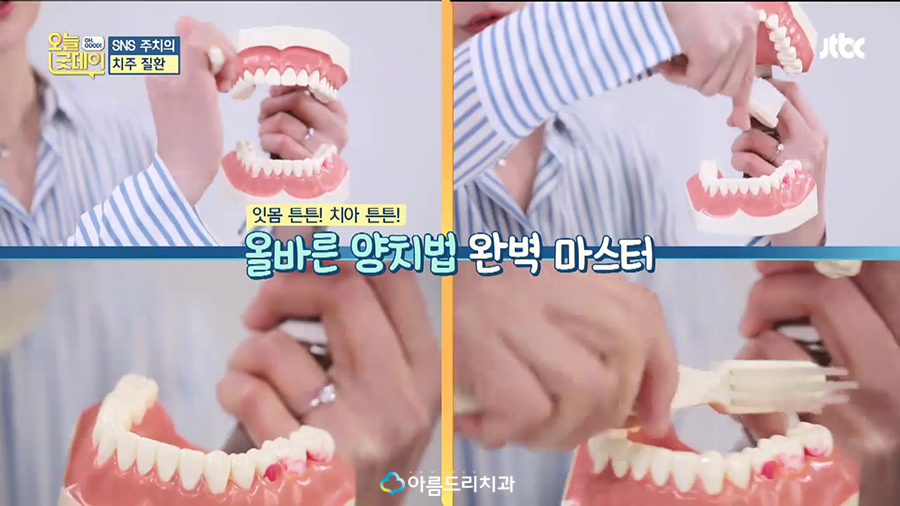 JTBC 오늘 굿데이 치주질환(잇몸병) 아름드리치과 이현정원장 관련 이미지 61