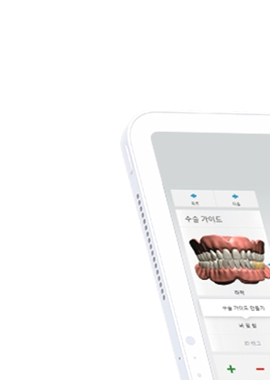 디지털임플란트 당일임플란트로 정확하고 안전하다면 관련 이미지 16