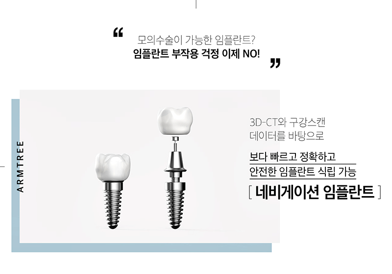 아름드리치과 임플란트의 안전성과 정확성을 높이다 관련 이미지 3