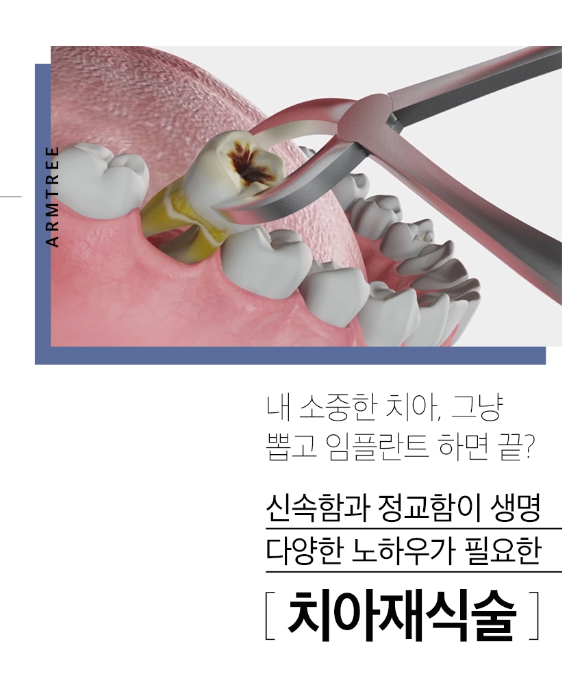 잇몸고름주머니치료 염증제거 아름드리치과 관련 이미지 6