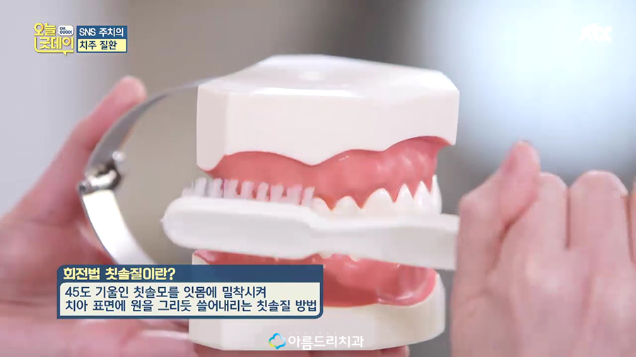 JTBC 오늘 굿데이 치주질환(잇몸병) 아름드리치과 이현정원장 관련 이미지 58