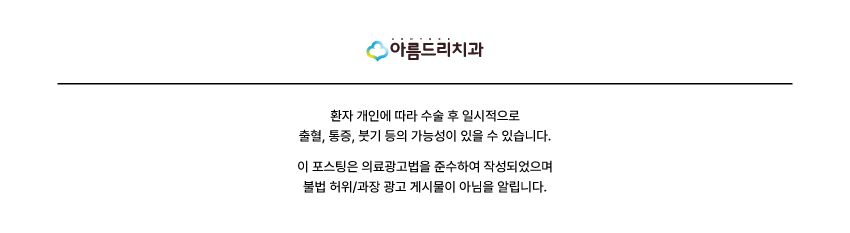 신논현역무삭제라미네이트 , 부작용 없이 예쁜 치아 가능할까? 관련 이미지 20