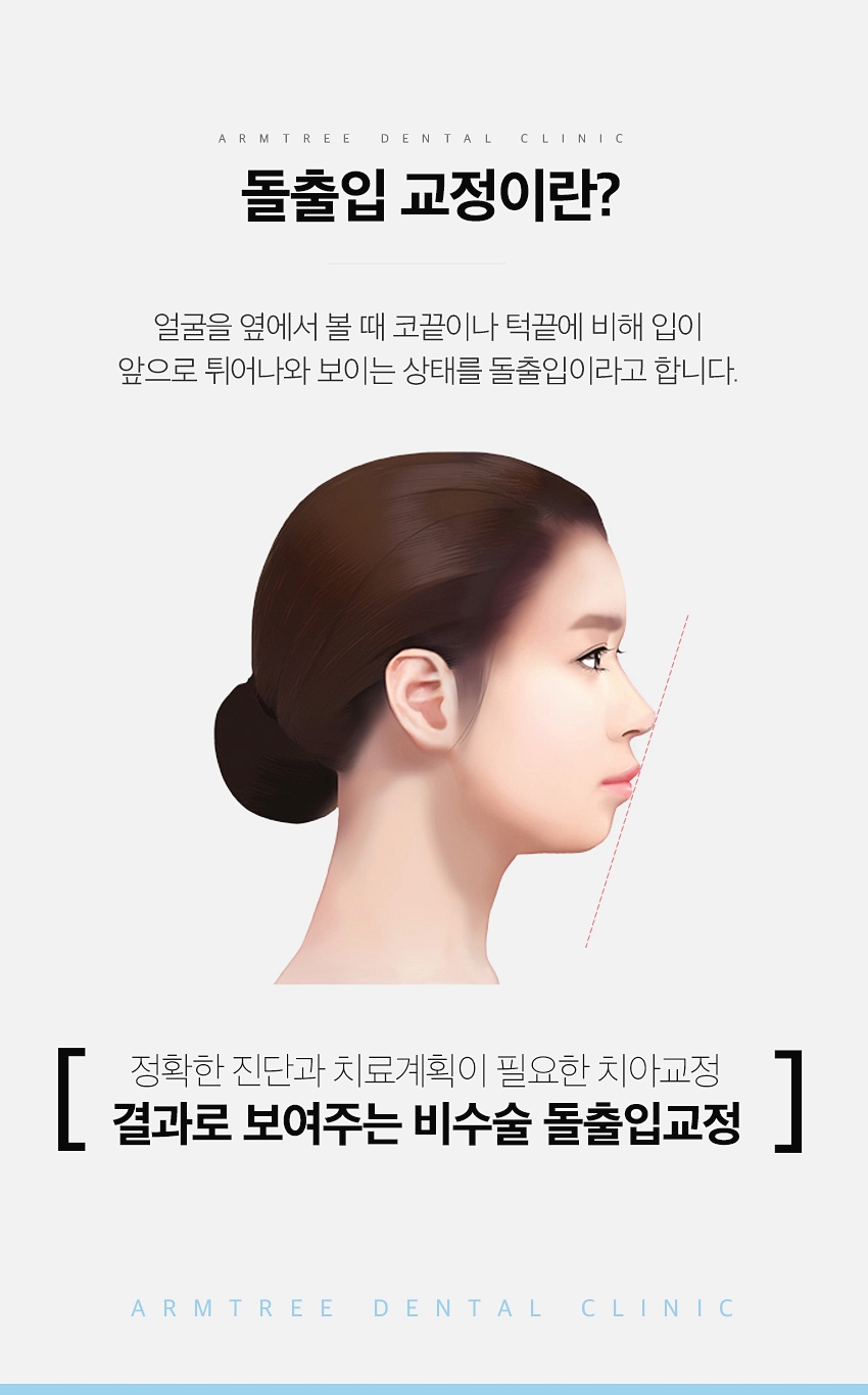 치아교정종류 신뢰가는 신논현역치과 관련 이미지 5